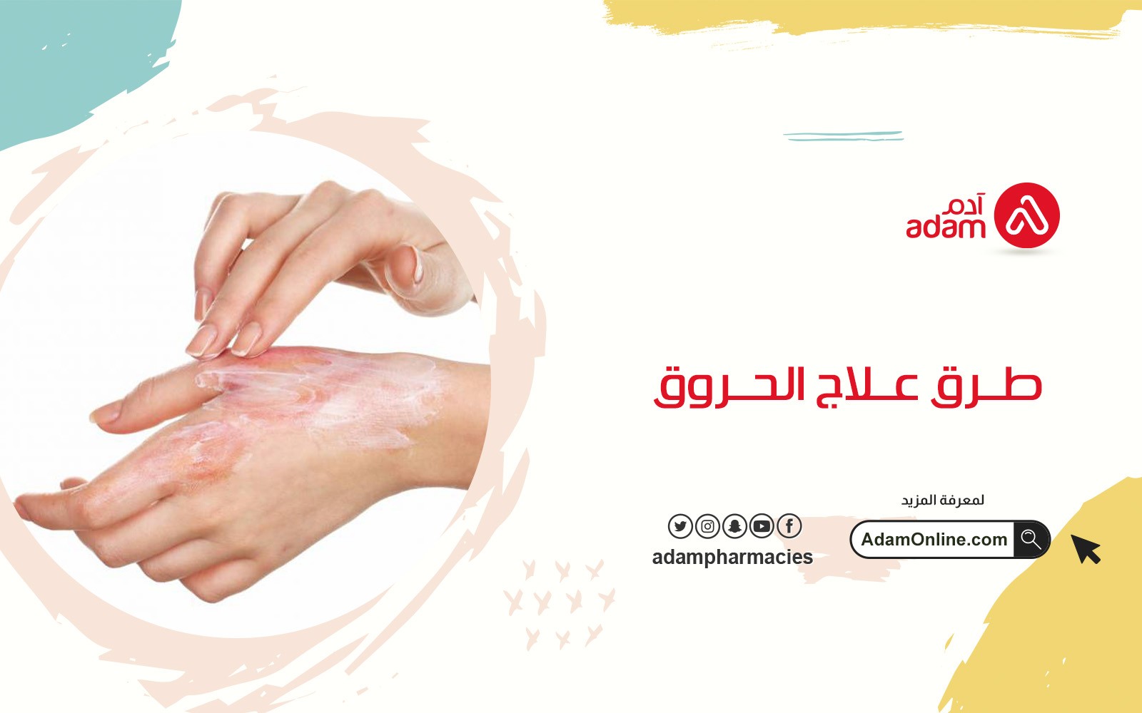 طرق علاج الحروق